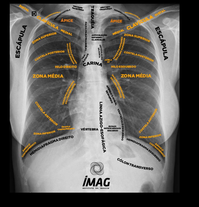 Anatomia do Tórax - IMAG