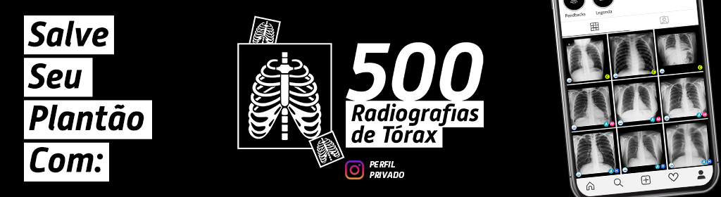 500 Radiografias de Tórax